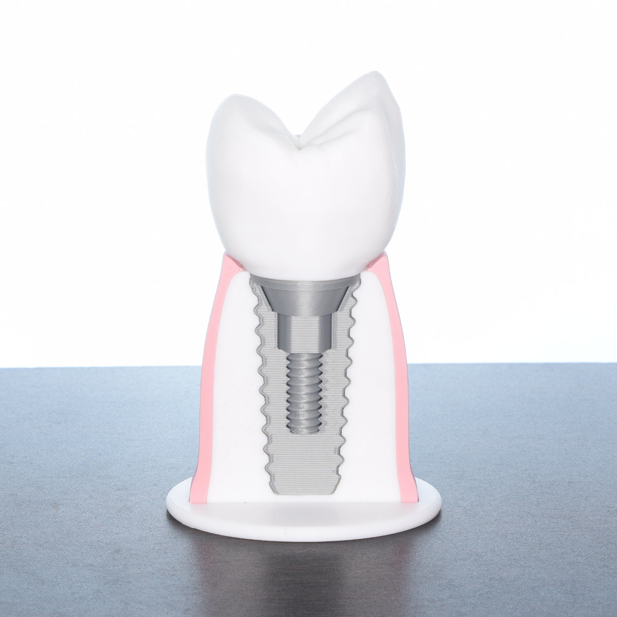 Dental Implant