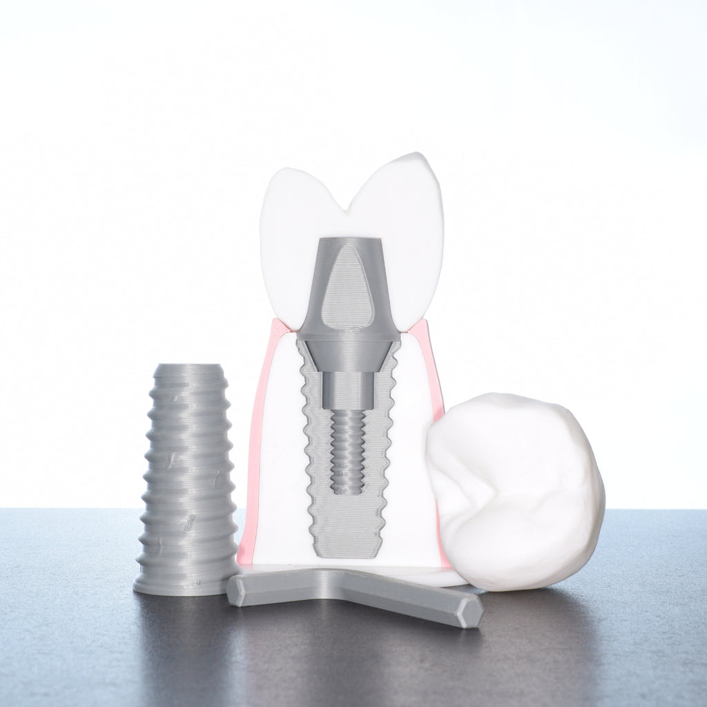 Dental Implant